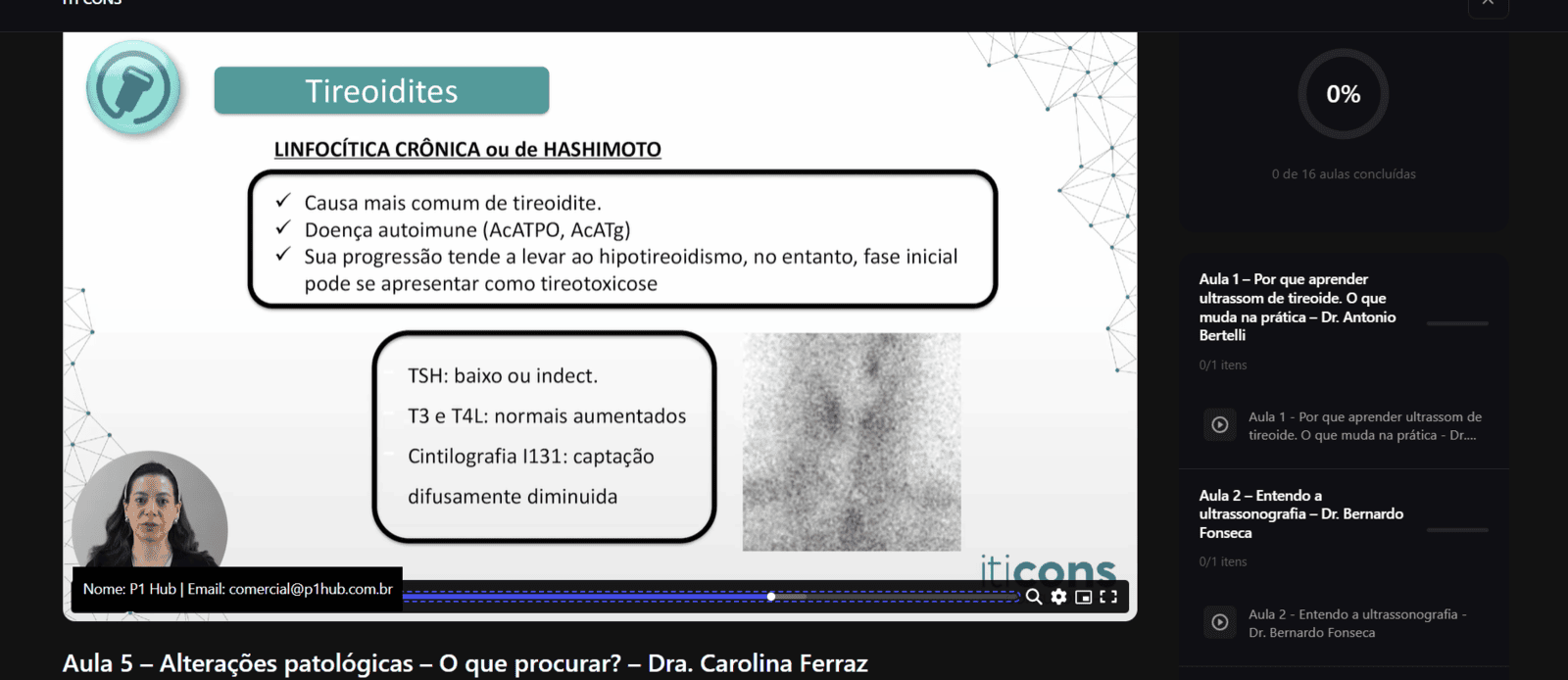 Preview de aula — ITI Cons Ultrassonografia